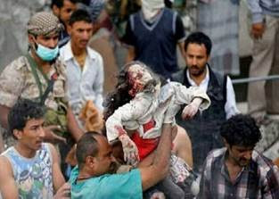 https://www.yemenpress.org/wp-content/uploads/2019/08/lvl2k20170927084637-696x392.jpg
