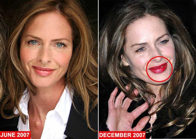  What Not to Wear, but perhaps she should have taken some advice from her 