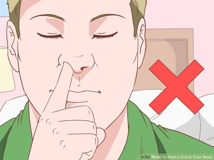 Heal a Cut in Your Nose Step 13 Version 2.jpg