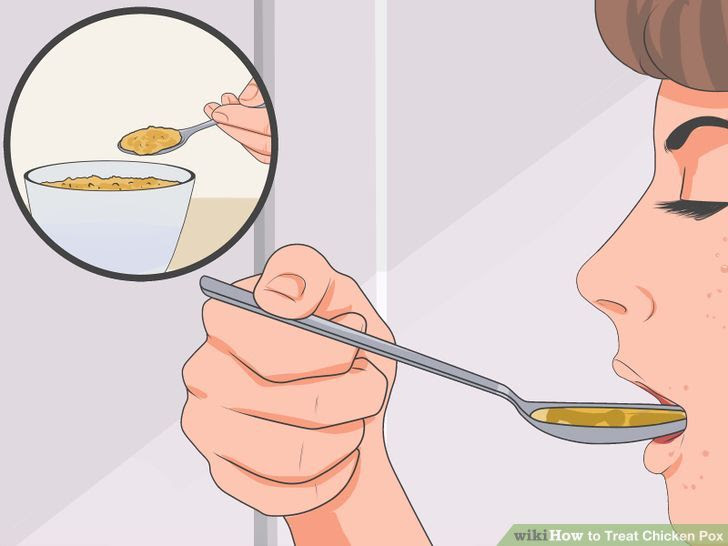Treat Chicken Pox Step 4 Version 2.jpg