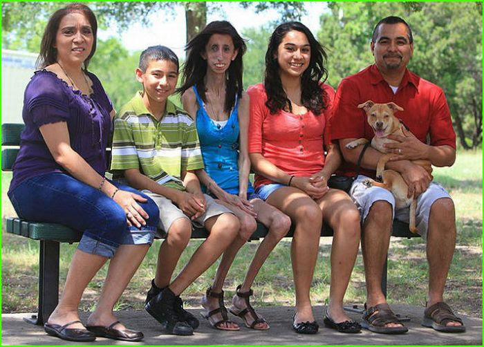 The Story of 21-year-old Lizzie Velasquez (17 pics)