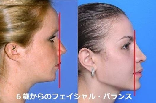 ６歳からバランスの良いお顔を育てることの意味 見た目だけじゃない歯並びの大切さ