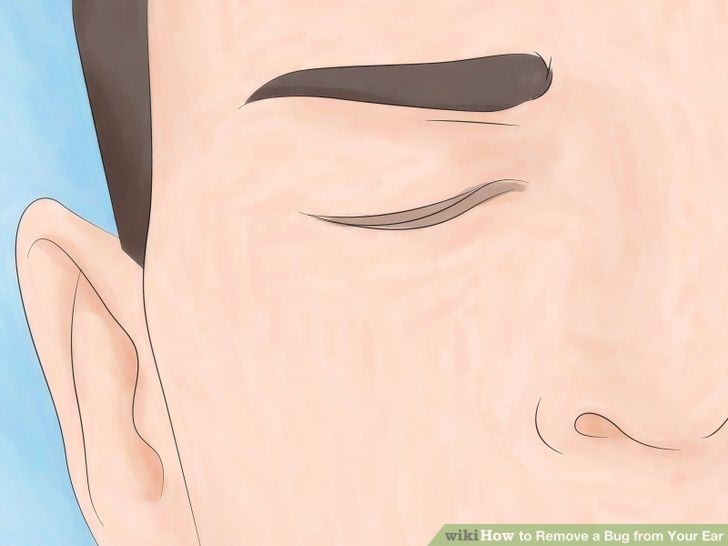 Remove a Bug from Your Ear Step 2 Version 2.jpg