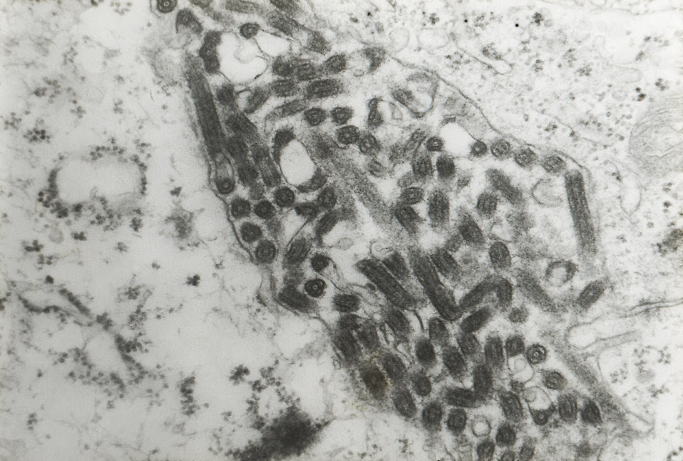 Virus | Free Stock Photo | Marburg virus transmission ...