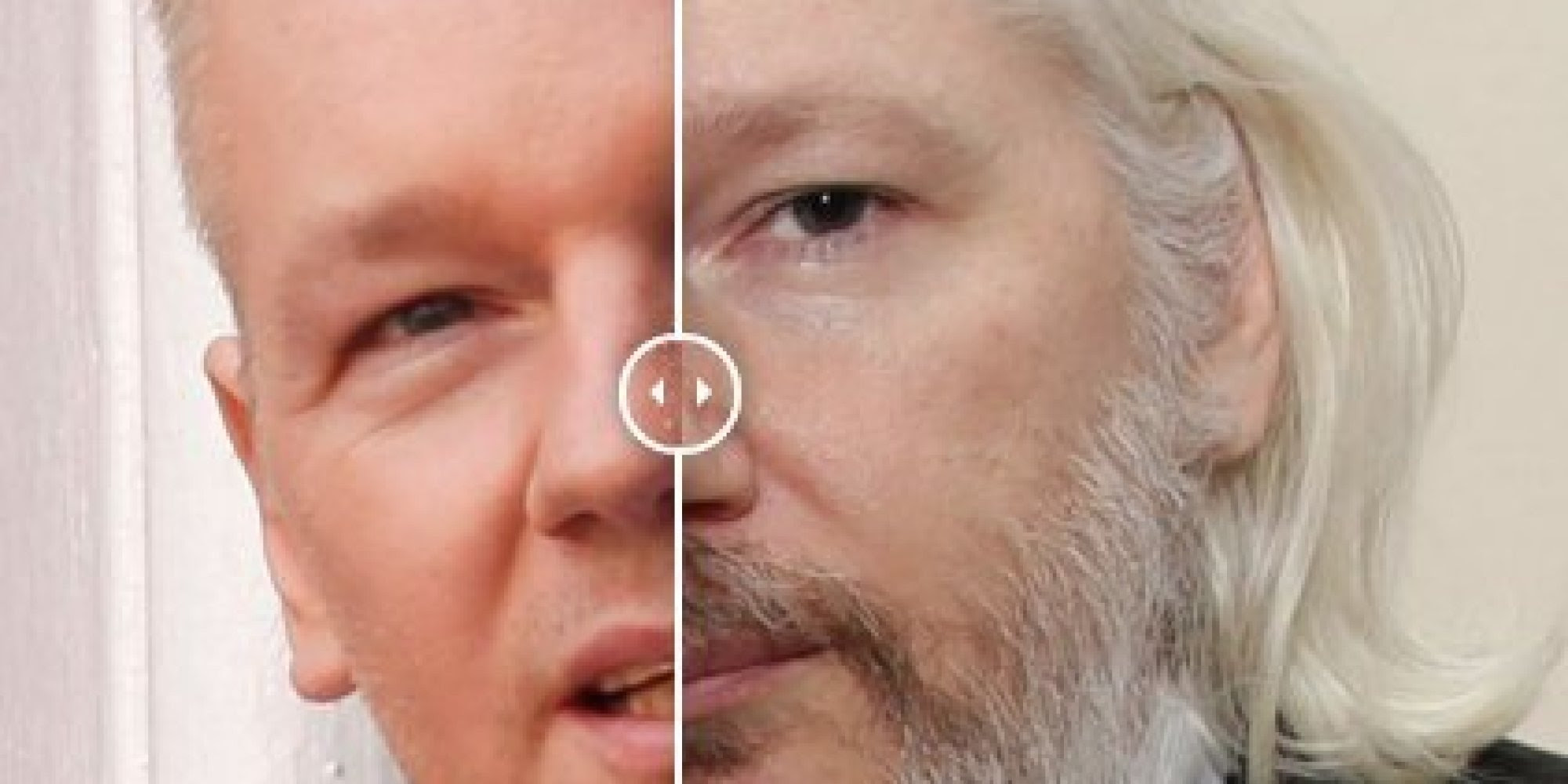 Julian Assange: Before-And-After Pictures Show Profound 