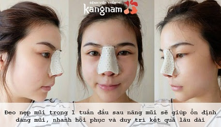 nâng mũi cấu trúc Nanoform6
