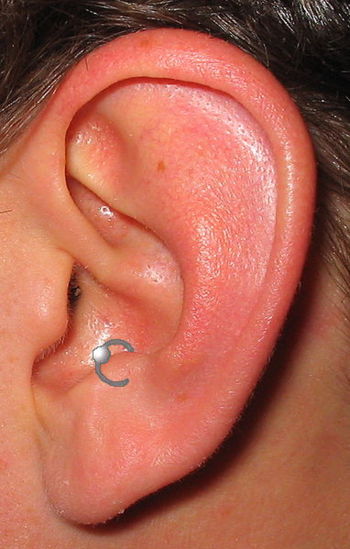A left human ear with a antitragus piercing dr...