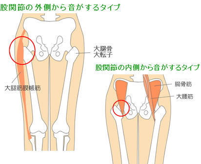 スポーツ主な疾患