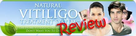 Natural Vitiligo Treatment System Review