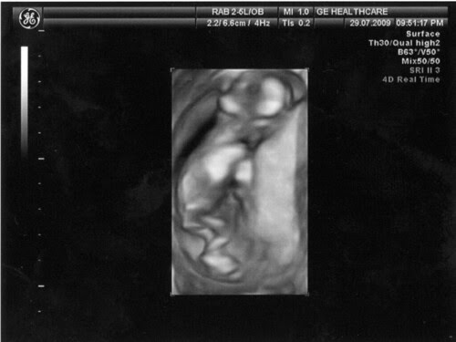 baby021 -1