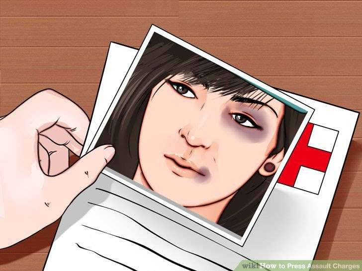 Press Assault Charges Step 9.jpg