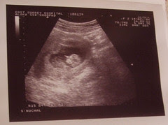 Scan #1