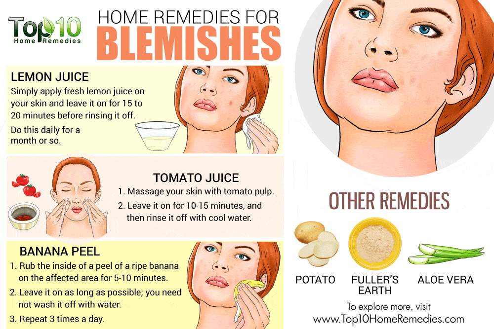 Home Remedies for Blemishes Top 10 Home Remedies