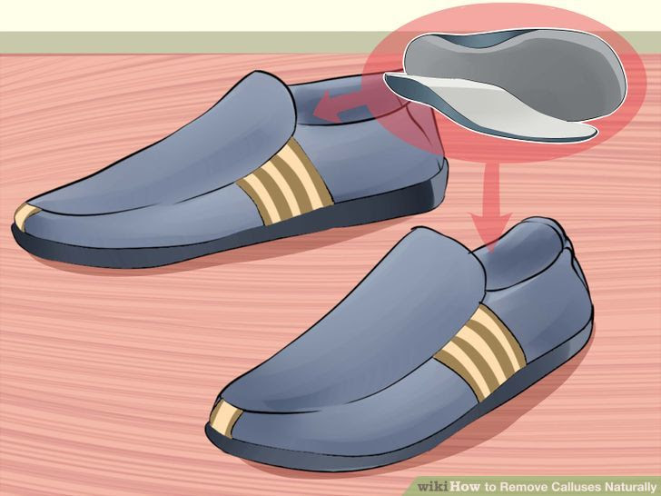 Remove Calluses Naturally Step 19 Version 2.jpg