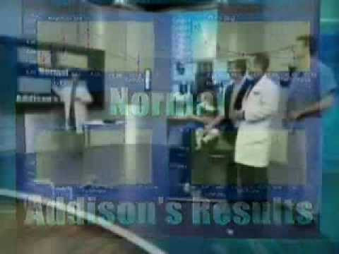 Nlp Eye Chart. eye chart test