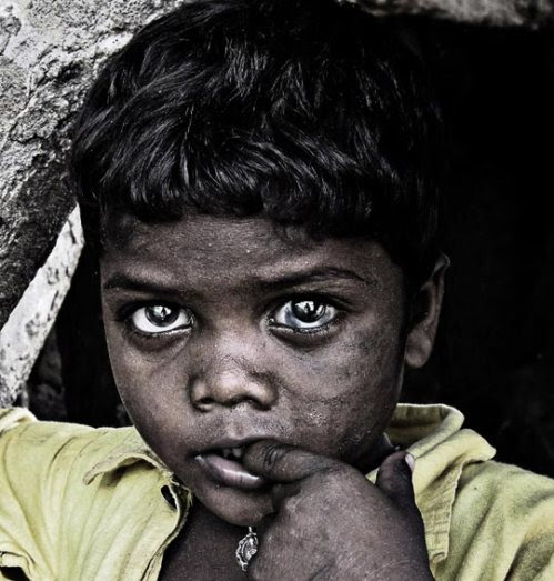 POVERTY 5