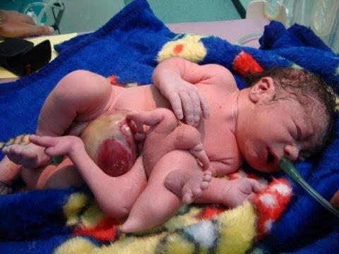 The Aftermath of Iraq Invasion: The Loss of Human Values (Graphic Images)