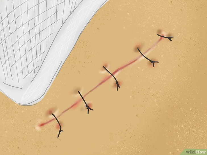 Get Rid of Stitch Marks Step 1 Version 2.jpg
