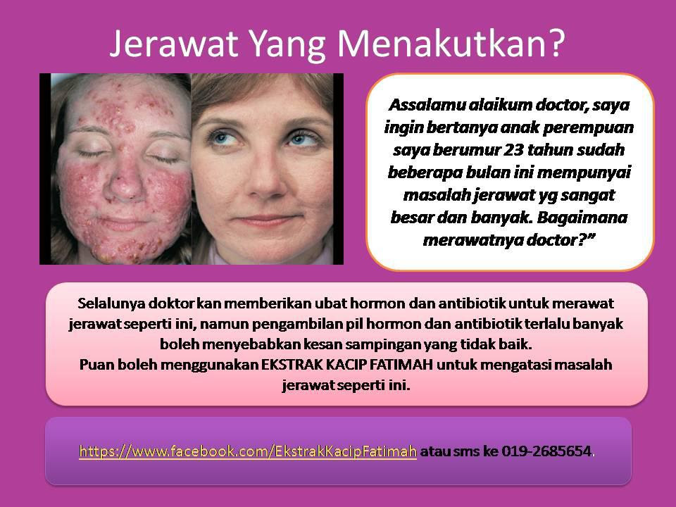 Merawat Jerawat dengan Pil Perancang  Dr Zubaidi Hj Ahmad 