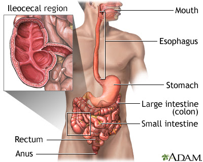 Crohn Disease