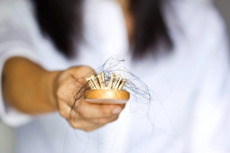 Hairloss