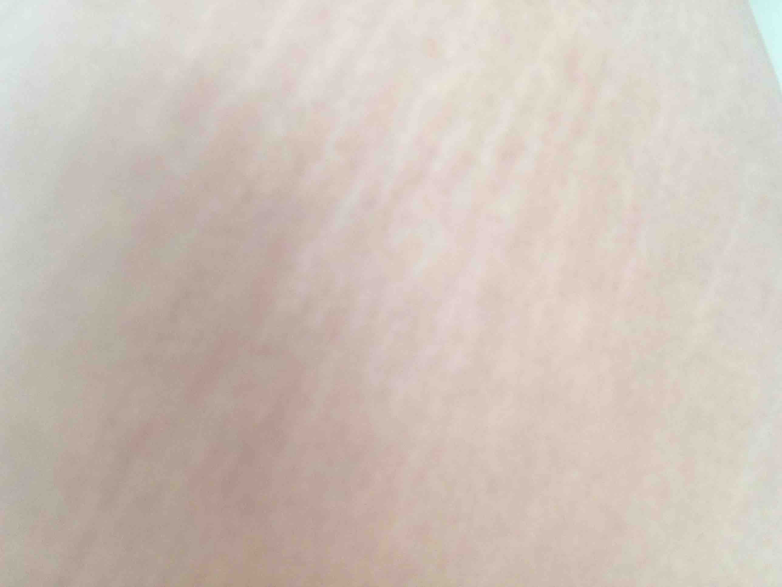 ダイエットにはアロマオイルも効果的 肉割れや妊娠線に困ってはいませんか 私が薄くした方法 ダイエット方法 Biz
