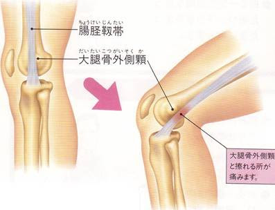 吉田整形外科 整形外科疾患の紹介