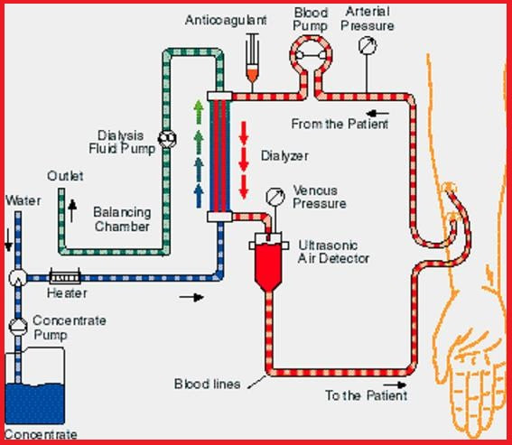 kidney problems protein dietary supplements