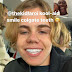 Kid Laroi Teeth : Dentists Urge Social Media Users Not To Embrace Trend That Involves Shaving Teeth To Pegs Tech Readsector : Sort by album sort by song.
