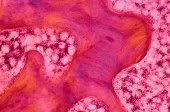 Stressed cells can halt protein production, which