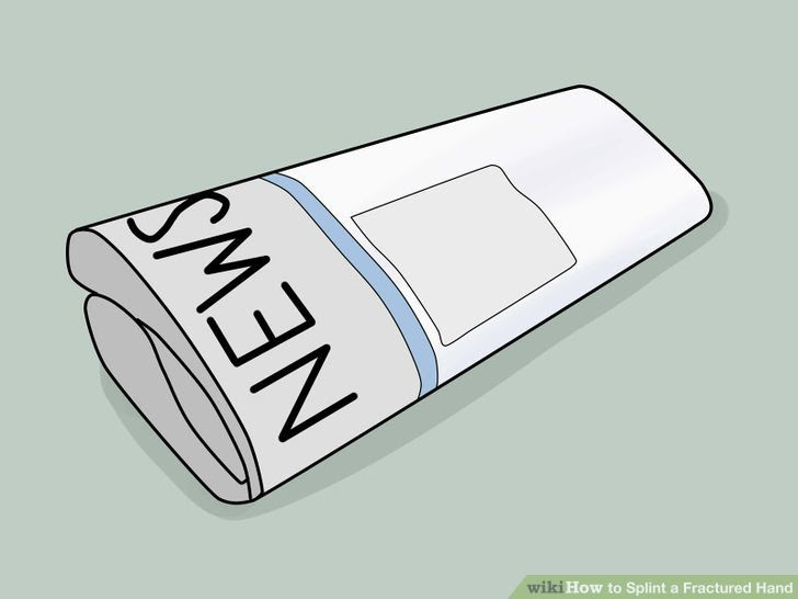 Splint a Fractured Hand Step 2.jpg