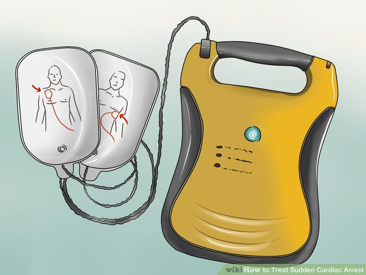 Do CPR on an Adult Step 16 Version 3.jpg