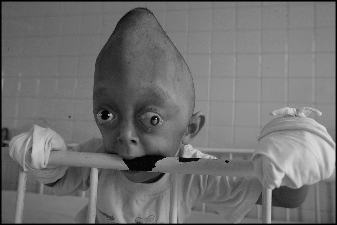 Alfred Yaghobzadeh Photography Vietnam Agent Orange Babies