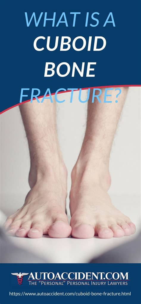 Wendy bumgardner is a freelance writer covering walking and other health and fitness. Cuboid Bone Fracture | Here are the things you need to
