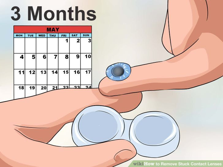 Remove Stuck Contact Lenses Step 17.jpg