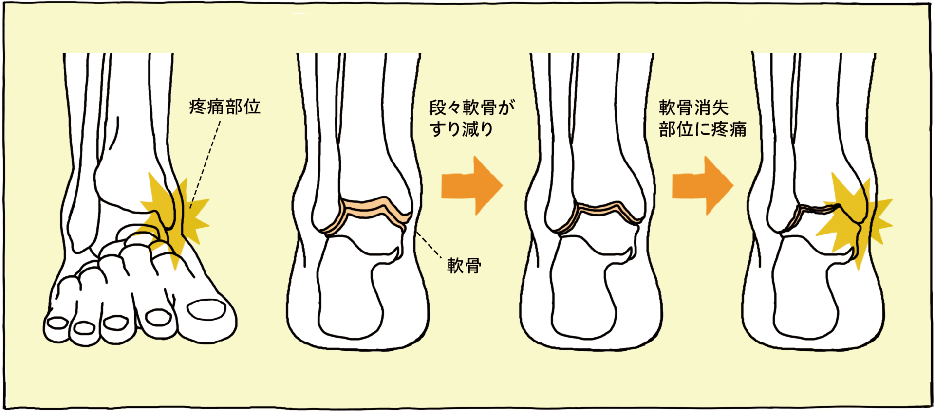 足首が痛い 原因 と 場所 から分類 解説 対処法 足のお悩み百科