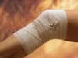 However, the painful infection comes back once