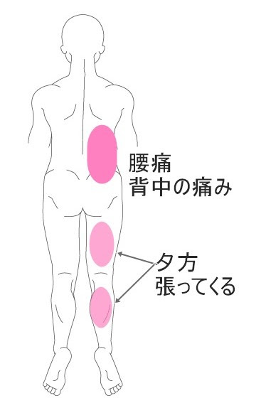 腰痛 坐骨神経痛症例38 80代男性 腰痛 背中痛 背中の痛み症例3 湯沢の整体 女性院長で安心 コスモス自然形体院