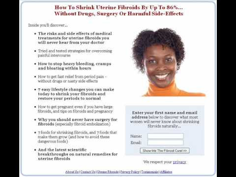 icd 9 code for lung cancer