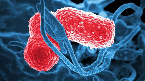 study shows  pneumonia causing superbug invades