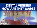 DENTAL HEALTH AND VENEERS