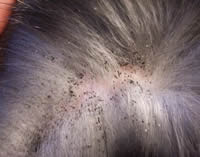 Les Parasites Externes Du Chat Puces Tiques Etc Mamaw Fr