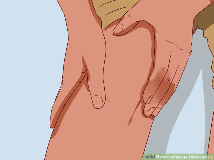 Manage Tuberculosis Step 8 Version 2.jpg