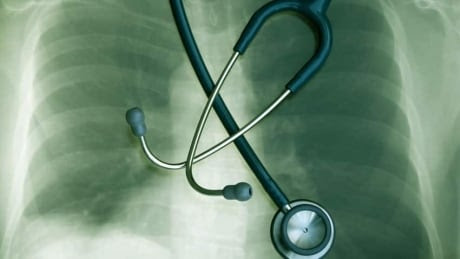 hi-lung-cancer-istock_00000