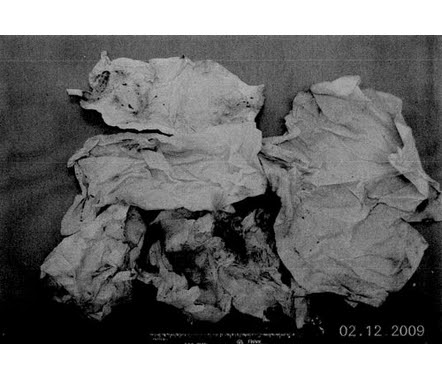 casey anthony pictures of evidence. Photographs: Casey Anthony
