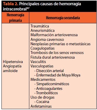 Enfermedad Vascular Cerebral