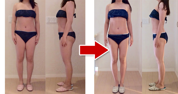 耳ツボダイエット マイナス6 1キロ達成 ２０代 3ヶ月