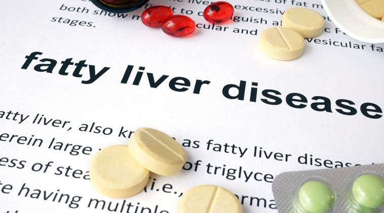 fatty liver disease, NAFLD, NAFLD menopause, non alcoholic fatty disease, menopausal women, menopausal women fatty liver disease, diabetes and menopause, health news