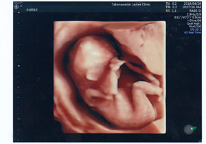 3d 4dエコー 高輪台レディースクリニック 港区の産科 婦人科 女医