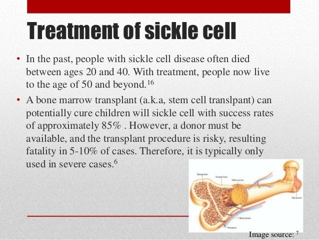 Treatments and Symptom management - Sickle Cell Anemia